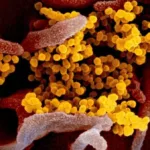 HMPV Virus Symptoms: What You Need to Know About the Human Metapneumovirus
